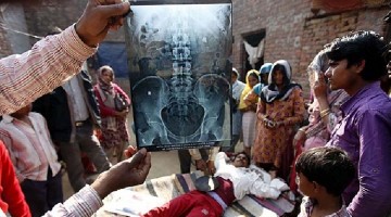 Growing India And Its Deteriorating Health: These Are Some Shocking Figures!